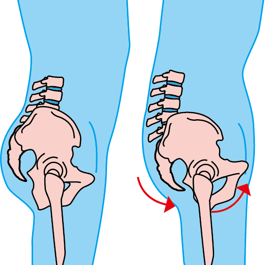 骨盤の傾斜